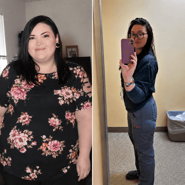 Samantha Casselman before and after